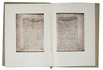 A landmark in Arabic ophthalmology: an 11th-century cataract operation by one of the most important Arab oculists