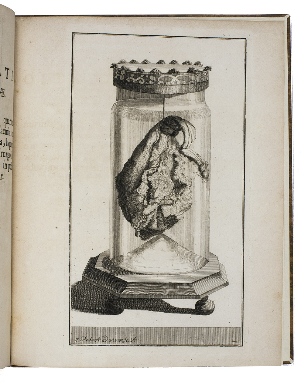 KOCH, Christian Andreas. - Affectum in libris et praxi rarissimum ab Hermanno Boerhaave in nosocomio Lugduno-Batavo.Leiden, Philippus Bonk, 1738. 4to. With a full-page plate of a human body part in formaldehyde and an engraved printer's device on the title-page. Also with some woodcut initials and headpieces. Modern half calf.
